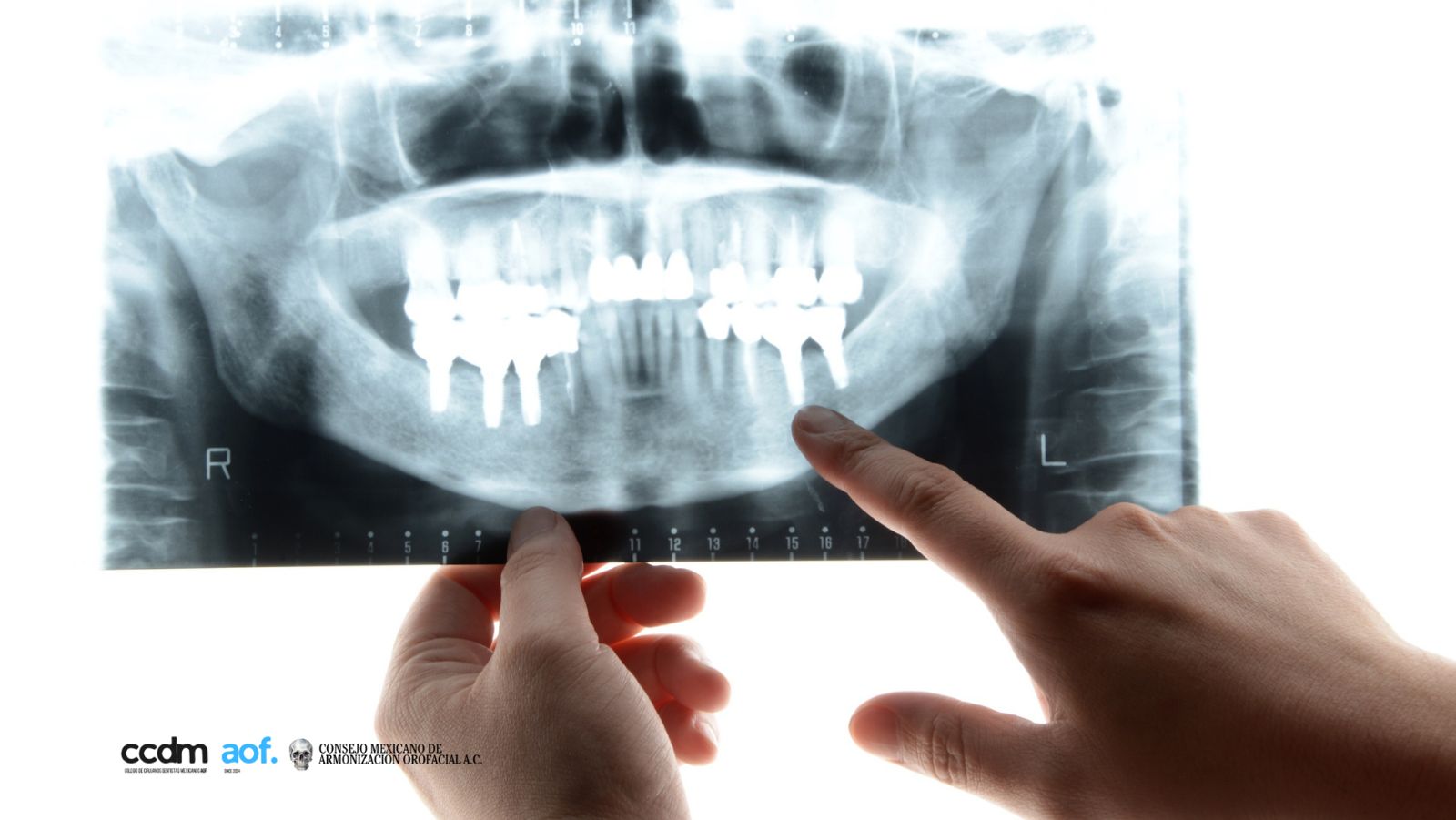 Tratamiento dental profesional